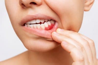 periodontal gum disease in women 641b6ae2edd79